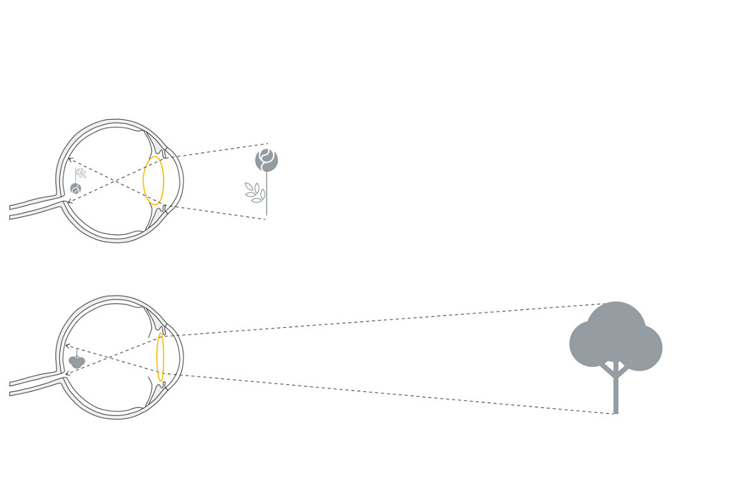 Acomodación: representación gráfica del tamaño del cristalino para la visión de cerca y la visión de lejos.