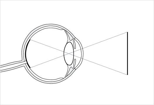 Grafik av ett öga som visar sfärisk aberration och dess inverkan på synuppfattningen.